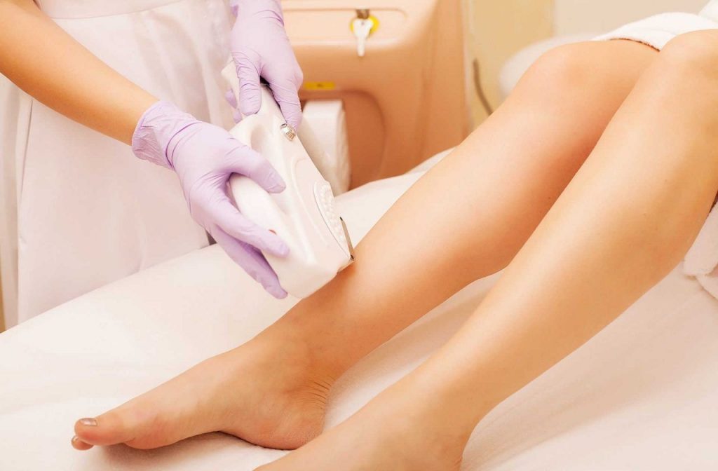 Everything A Bride-To-Be Needs To Know About Full Body Laser Treatment